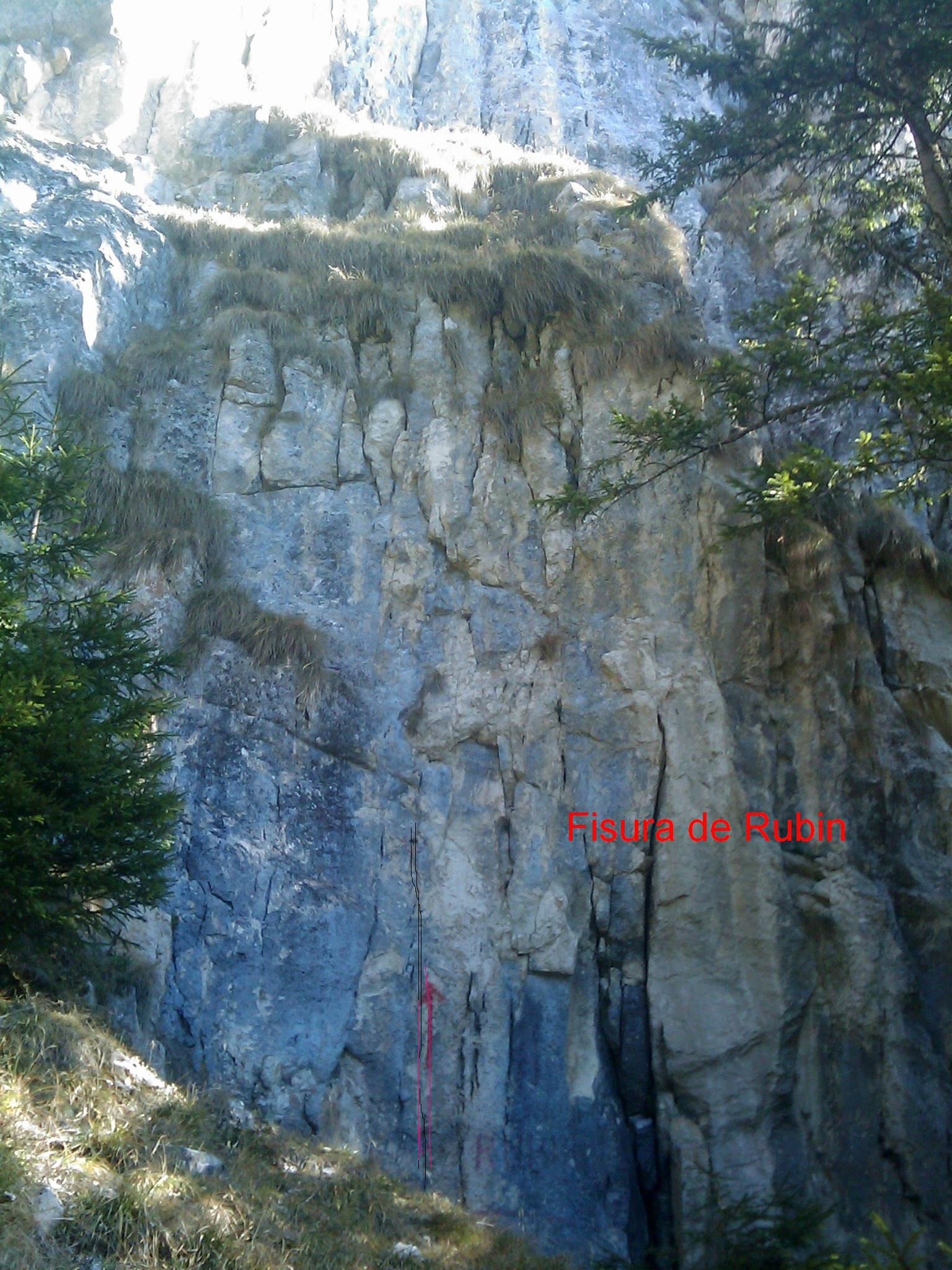 fisura de rubin